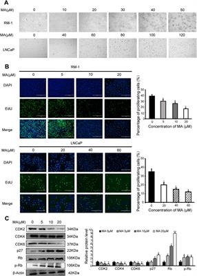 Maslinic acid induces autophagy and ferroptosis via transcriptomic and metabolomic reprogramming in prostate cancer cells